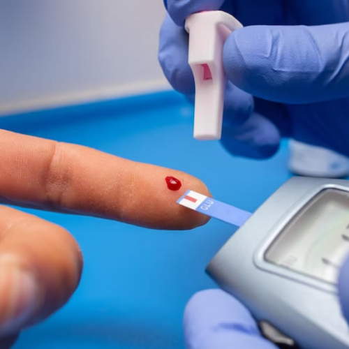 Andalucía lidera la integración de datos de monitorización flash de glucosa en la historia clínica digital para personas con diabetes